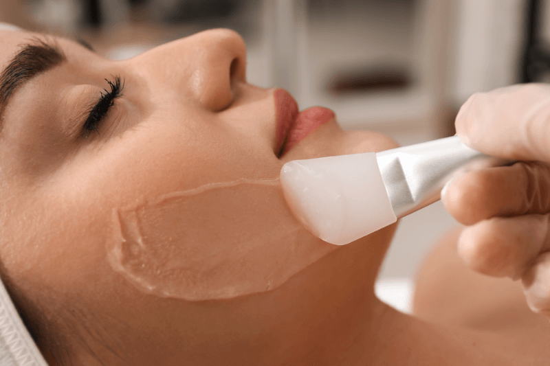 Chemical/Organic Peel Treatments